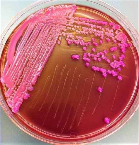 Klebsiella Pneumoniae On Macconkey Agar