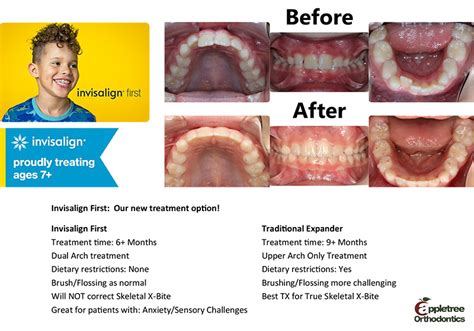 Invisalign Clear Braces Londonderry Nh Orthodontist