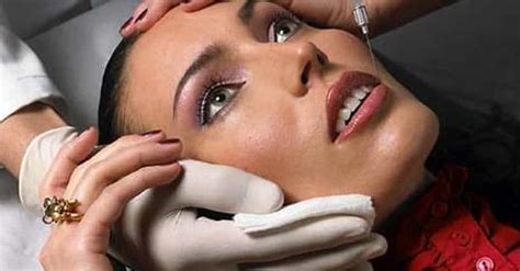 Worst Celebrity Botox | List of Obvious Injections & Fillers