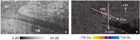 Figure From Improved Phase Resolved Optical Doppler Tomography Using