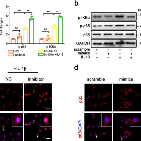 Mir P Inhibits The Activation Of Nf Kb Signaling Pathway A