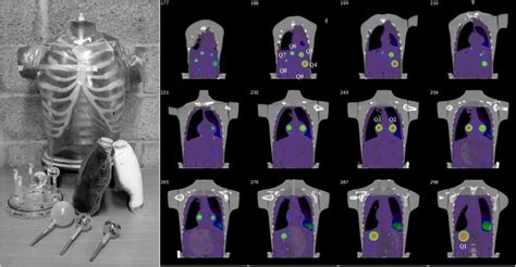 A Torso Phantom Left And Nine Spherical Inserts Right Seven Of The Download Scientific