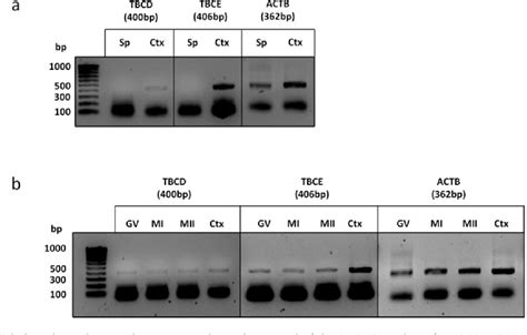 Figure 1 From Expression And Localization Of Tubulin Cofactors TBCD And