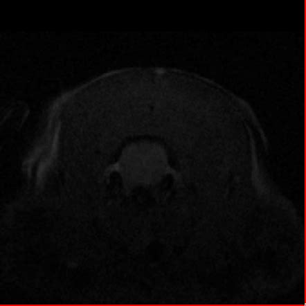 Mouse Brain Anatomical Mri D Biomedical Research Imaging Center