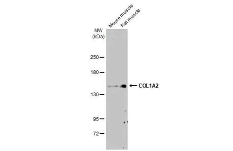 COL1A2 Antibody HL2049 Azide and BSA Free Novus Biologicals 100 μL