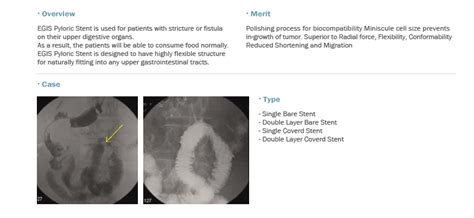 Egis Pyloric Stent Bvm Medical