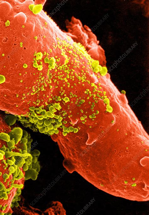 Hiv Particles Budding From Cell Stock Image C Science