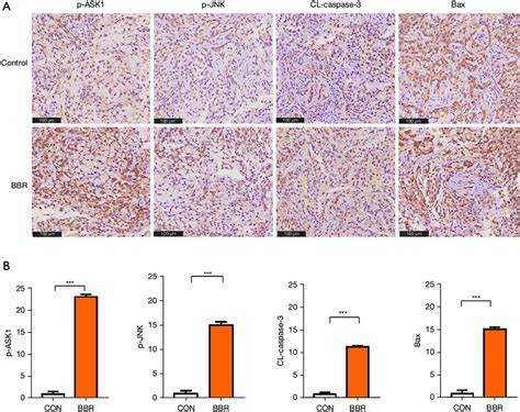 Bbr Induced Nsclc Cell Apoptosis Via The Activation Of The Ask1jnk