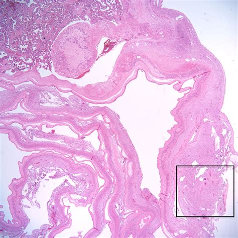 Chapter Placental Perfusion Section A Spiral Arteries Obstetrical