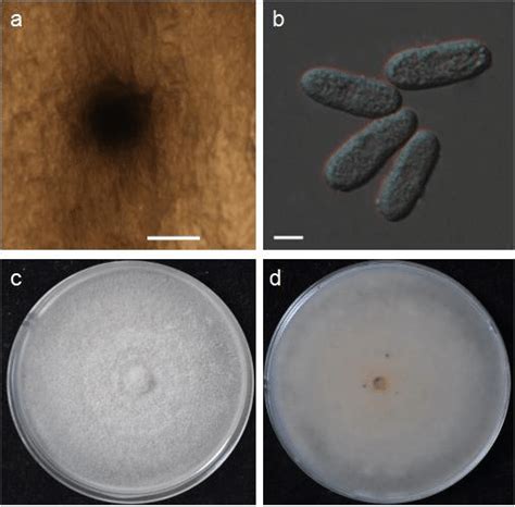 Colletotrichum Sp Strain Fj074 A Conidioma On Pda B Conidia C