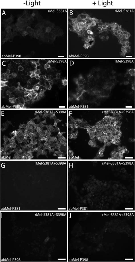 Photomicrographs Showing Immunostaining For Melanopsin And