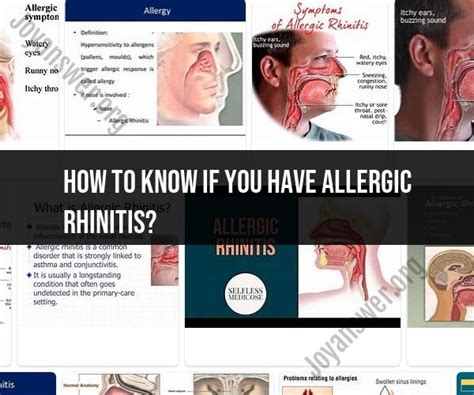 Recognizing Allergic Rhinitis Signs Symptoms And Diagnosis