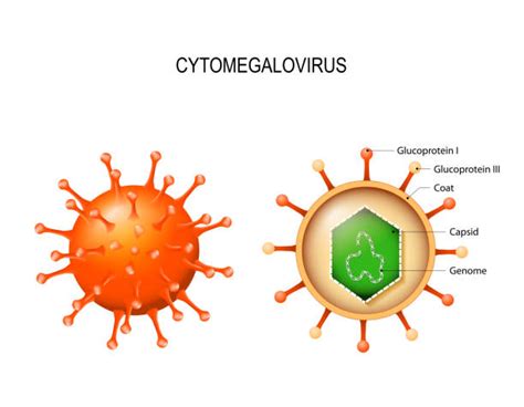 Cytomegalovirus Illustrations, Royalty-Free Vector Graphics & Clip Art ...