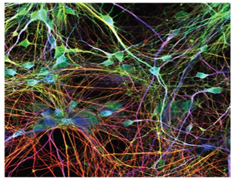 Years and Years… of Dopaminergic neurons – openlabnotebooks.org