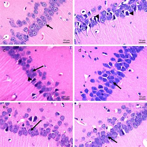 Photomicrographs Of CA3 Region Of The Hippocampus Stained With H E