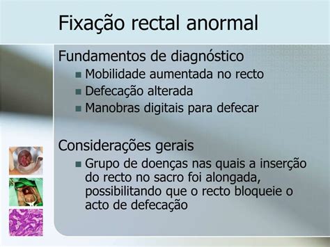 Ppt Patologia Perianal Powerpoint Presentation Free Download Id 829116