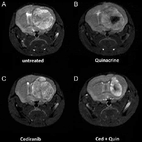 Representative T 2 Weighted Coronal Mouse Brain MR Images Obtained At