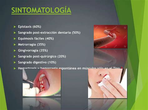 Enfermedad De Von Willebrand Von Willebrand Ppt