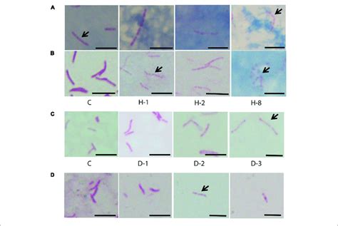 Acid Fast Staining Of M Tuberculosis Cells In Sputum Oxidative Download Scientific Diagram