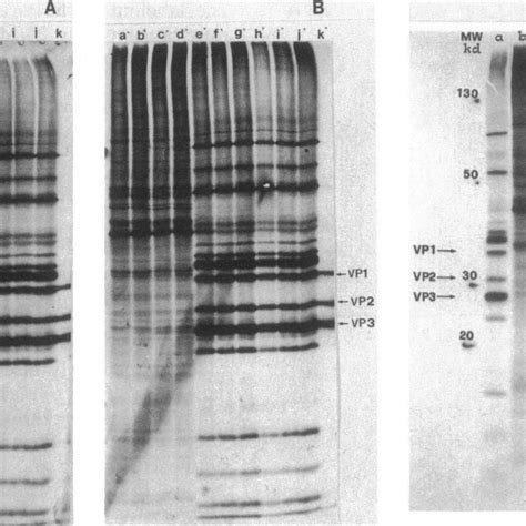 Analysis By Sds Polyacrylamide Gel Electrophoresis Of The Proteins Download Scientific Diagram