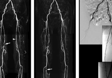 MRI Contrast Agents Compared at Different Dosing