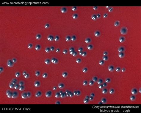 Culture of Corynebacterium diphtheriae (gravis) bacteria, rough type on ...