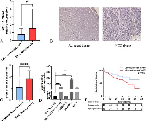 MYEF2 Expression In HCC Tissue And Cell Lines A Fluorescent