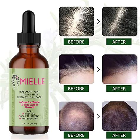 Mielle Organics Aceite Para Fortalecer El Cuero Cabelludo Y El Cabello