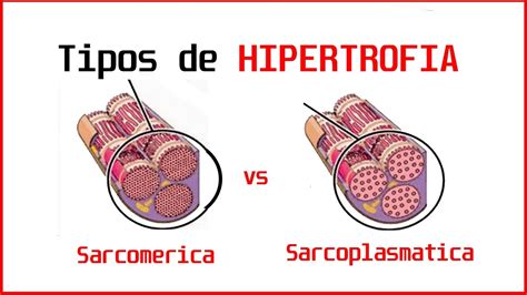 Tipos De HIPERTROFIA MUSCULAR SARCOMERICA Y SARCOPLASMATICA