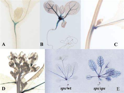 Control Of Axillary Bud Initiation And Shoot Architecture In