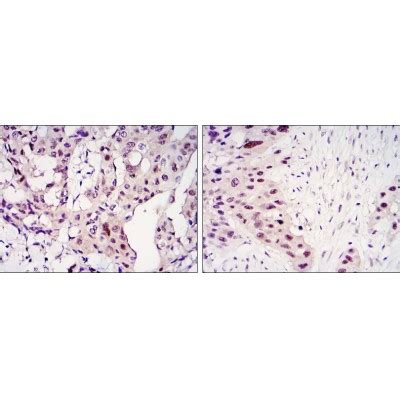 Stat Antibody Affinity Biosciences Ltd