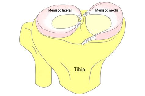 Traumatólogo Especialista En Rotura De Menisco En Madrid