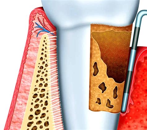 Natural Looking Dental Implants London Smile Studio