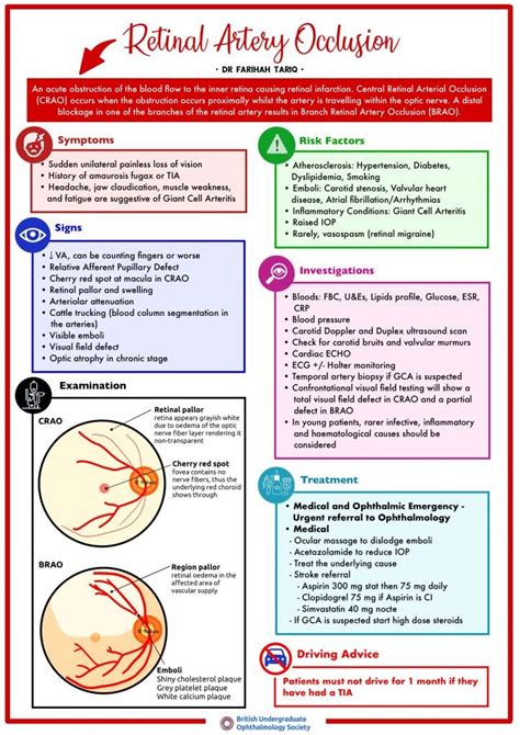 Retinal Artery Occlusion – British Undergraduate Ophthalmology Society