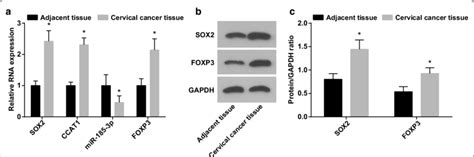 MiR 185 3p Expression Decreases While SOX2 CCAT1 And FOXP3