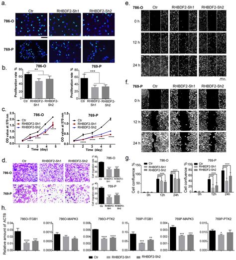 Rhbdf2 Knockdown Restricted Renal Clear Cell Tumor Proliferation And Download Scientific