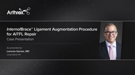 Arthrex Internalbrace™ Ligament Augmentation Procedure For Aitfl Repair