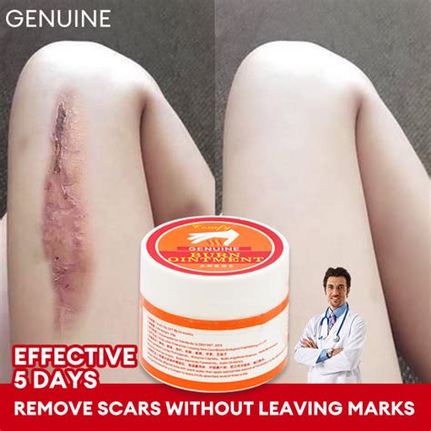 Scars Remover For Old Scars Scar Remover Peklat Remover Scar Remover