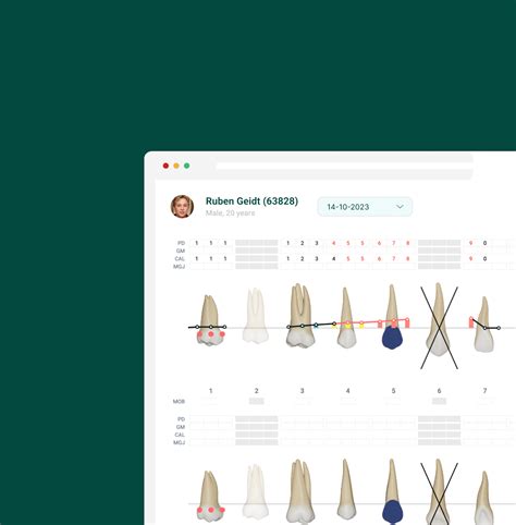 Dental Charting Software | Benefits & FAQs | CareStack®