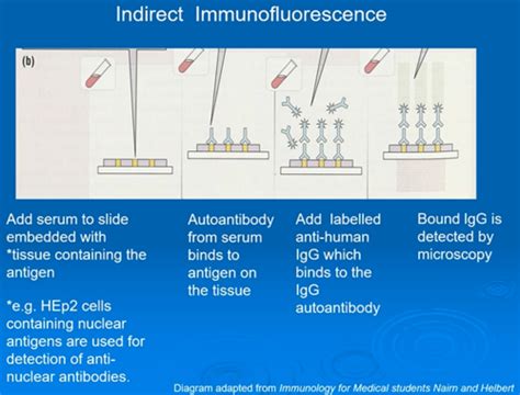 Diagnostic Immunology Sle And Connective Tissue Disease Flashcards