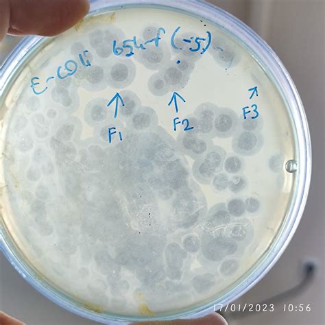 Escherichia coli bacteriophage 100654F – Mikroliz