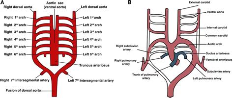 Canine Persistent Aortic Arch