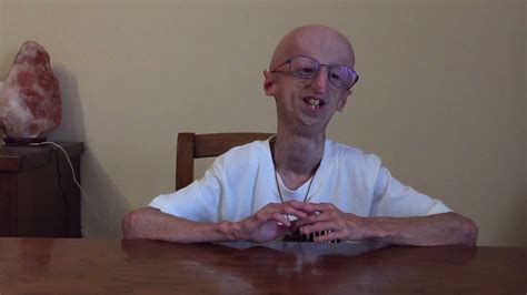 Prf Sammy Basso Shares His Excitement On The State Of Progeria