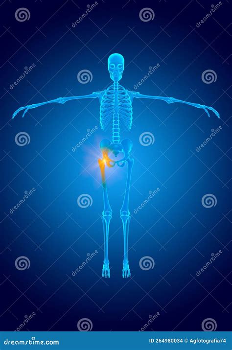 Blue Hologram Pain In The Femur Joint Caused By Cartilage Wear Stock