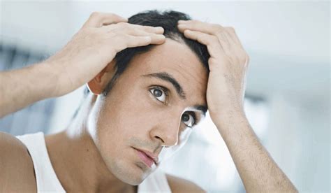 How Hair Loss Affects A Man S Mental Health Ape To Gentleman