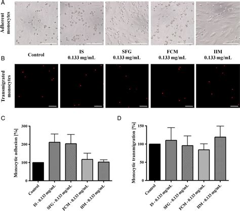 Monocytic Adhesion On Activated Huvecs And Transmigration Through M