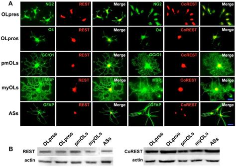 Expression And Subcellular Localization Of Rest And Corest In Glial