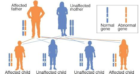 Woody Guthrie who Suffered from Huntington’s Disease – Platform | CME