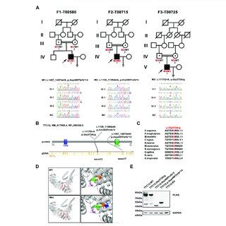 PDF Novel Homozygous Variants In TTC12 Cause Male Infertility With