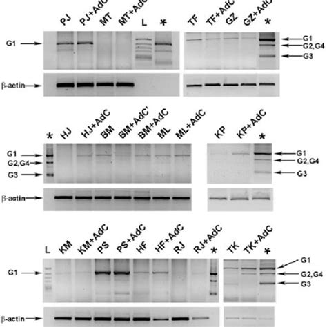 Semi Quantitative Rt Pcr Analysis Of Hla G Transcripts G1g4 Following Download Scientific